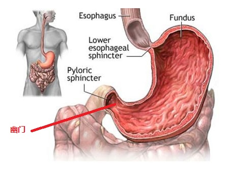 幽门梗阻的知识信息汇总